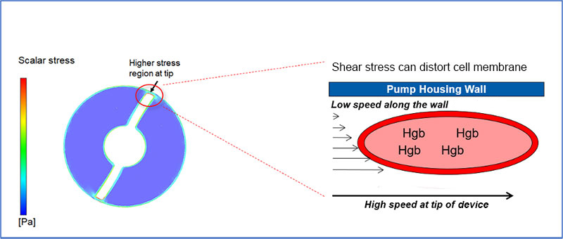 Image showing what hemolysis is